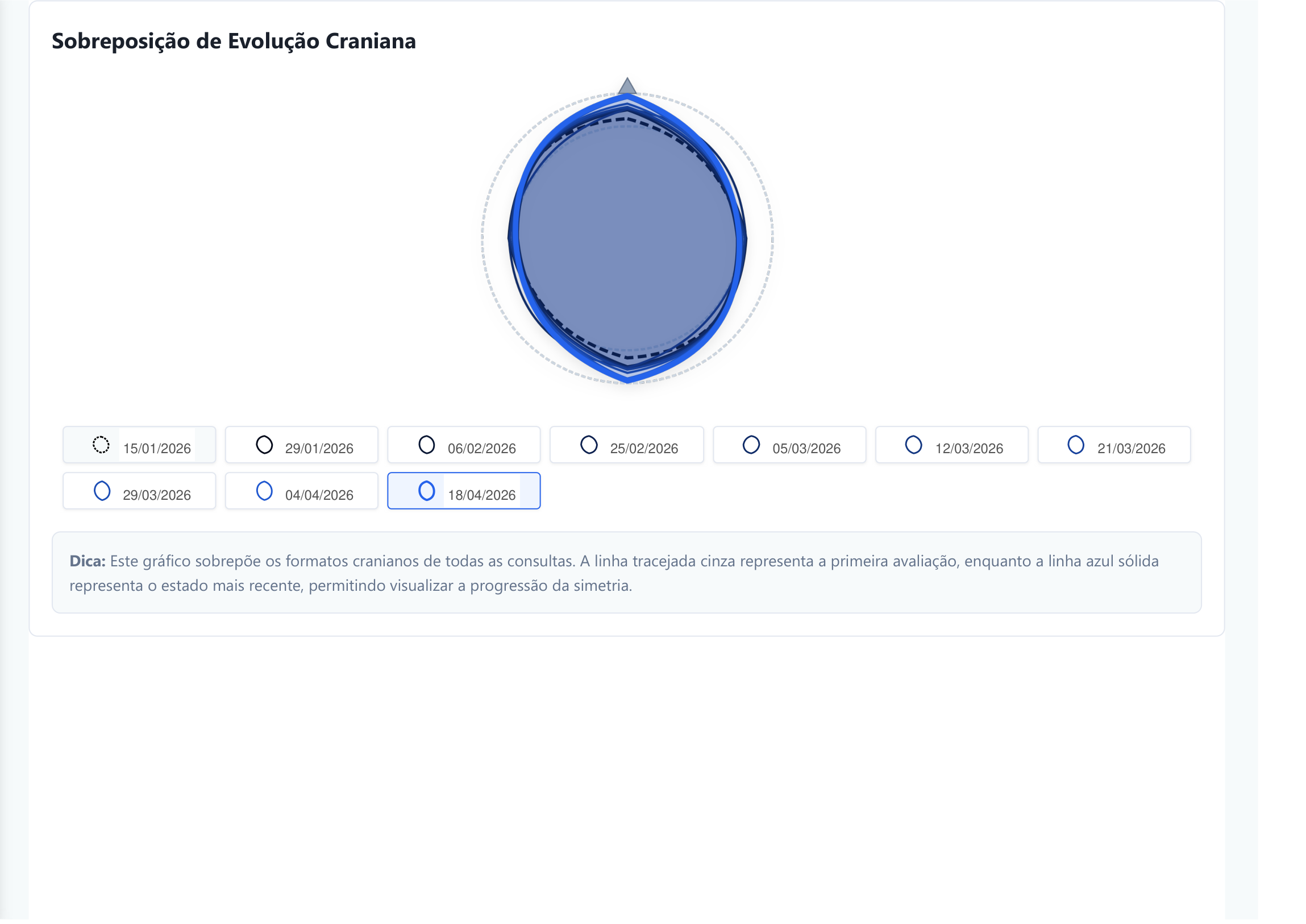 Sobreposição da evolução do formato craniano ao longo das consultas